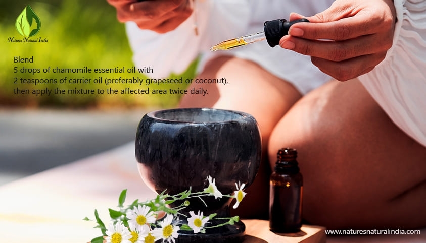 Chamomile essential oil 