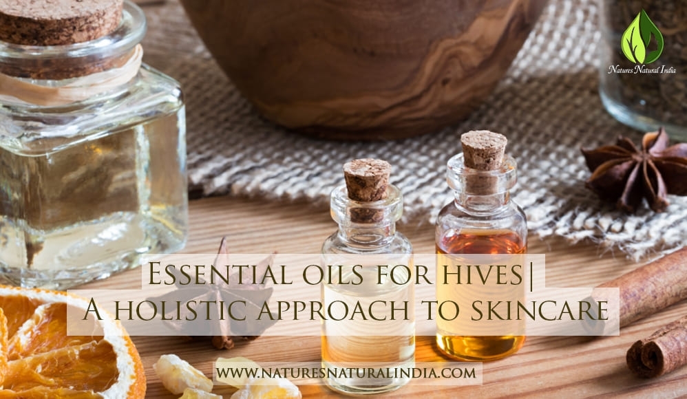 Essential Oils For Hives Holistic Approach To Skincare